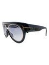 Gafas "Alana TF360"